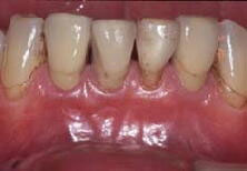 �C���v�����g���Ì�